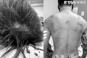 Toyz傷勢照曝光！「頭破出大深坑」血肉模糊　網見照片怒噴超哥：出手太狠了