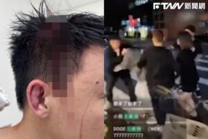 Toyz當街遭毆「頭破大坑」！超哥親訴動手原因：忍無可忍，無須再忍